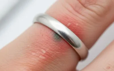 L’argent 925 est-il hypoallergénique ?