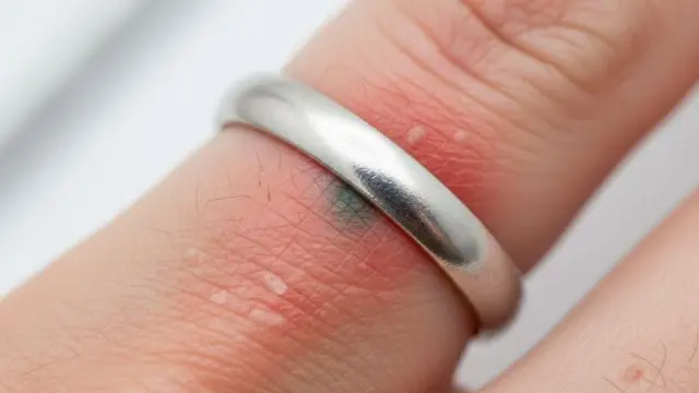 L'argent 925 est-il hypoallergénique ?